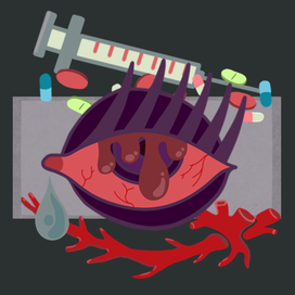 На дне "колодца" - аневризма 