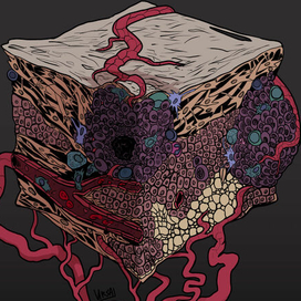 TME (tumor micro-environment)