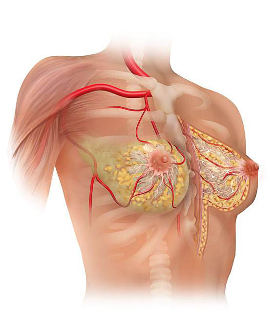 Medical Illustration