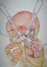 Первая необходимость.