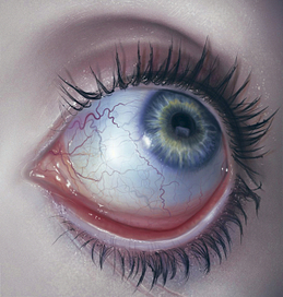 eye