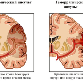 Анатомия