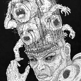 Инфантилизм