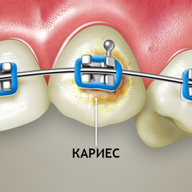 для стоматологий 6