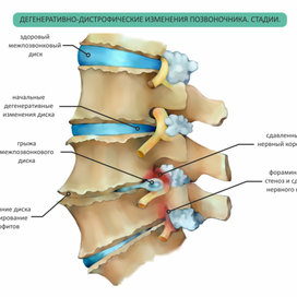 Иллюстрация позвоночника