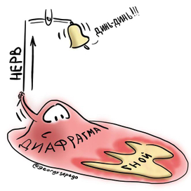 Френикус-симптом