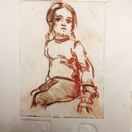 Сухая игла. " Ребенок"