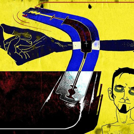 Иглоукалывание