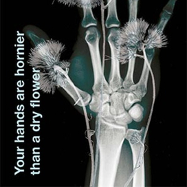 Жесткие руки