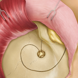 Медицинская иллюстрация