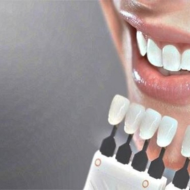 Уникальные зубные пасты и отбеливающие полоски в магазине «White-is-easy»