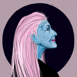 пластическая операция