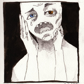 гетерохромия