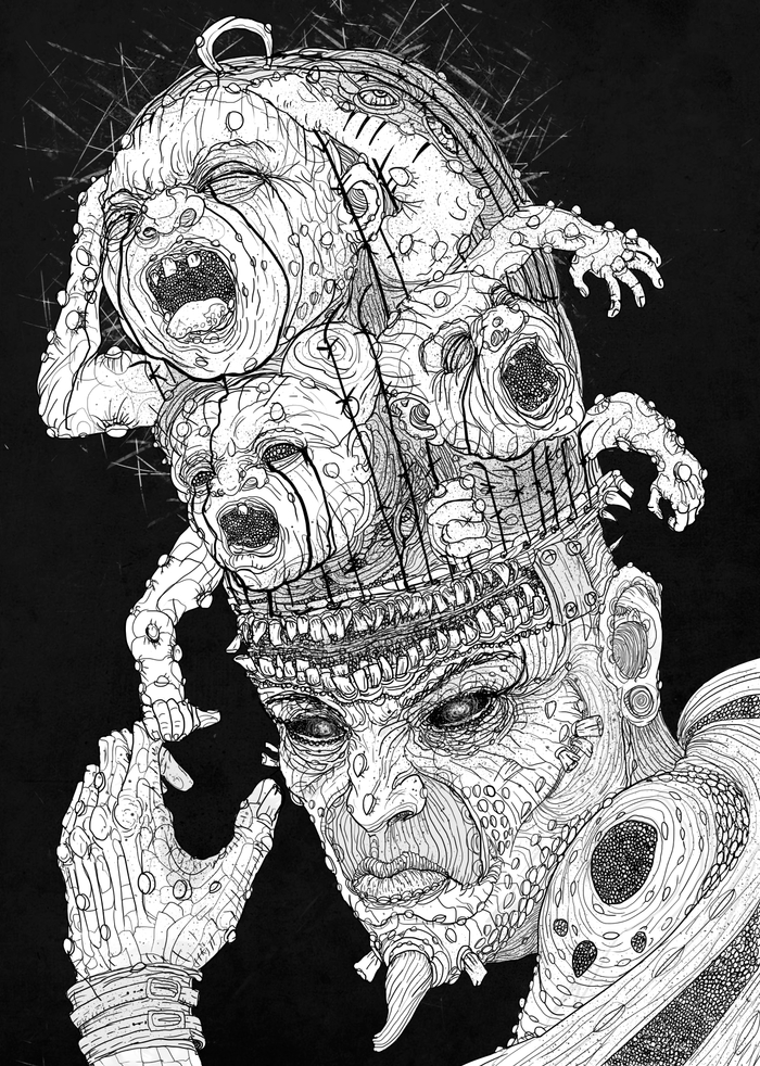 Инфантилизм