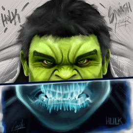 Халк у стоматолога