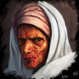 Прокаженный индиец 