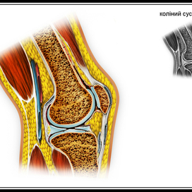 коленный сустав