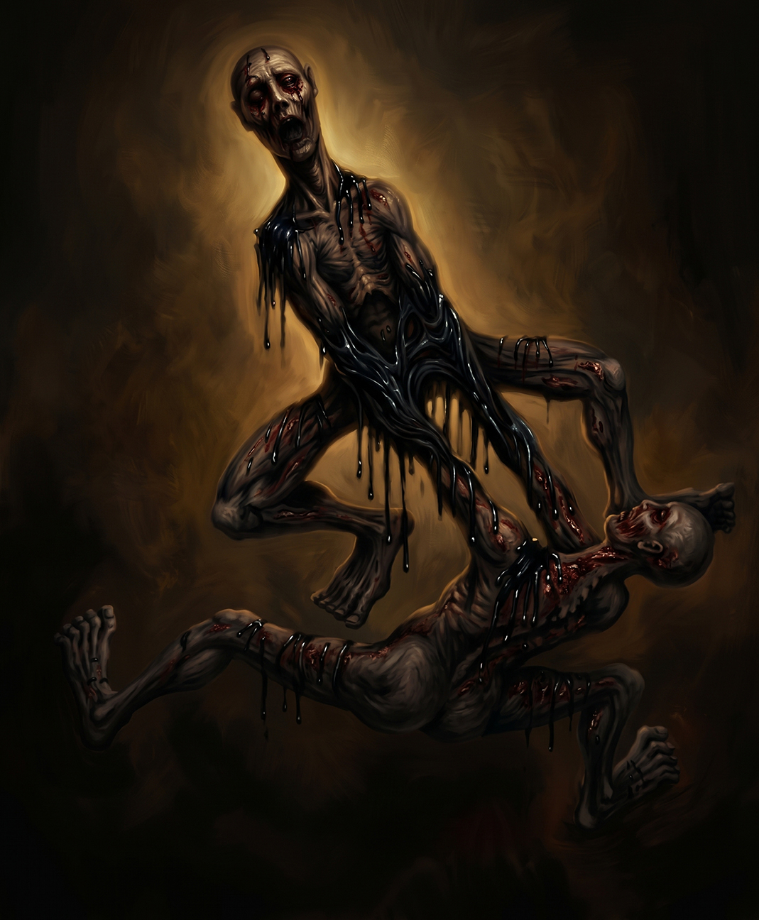 Siamese twins new