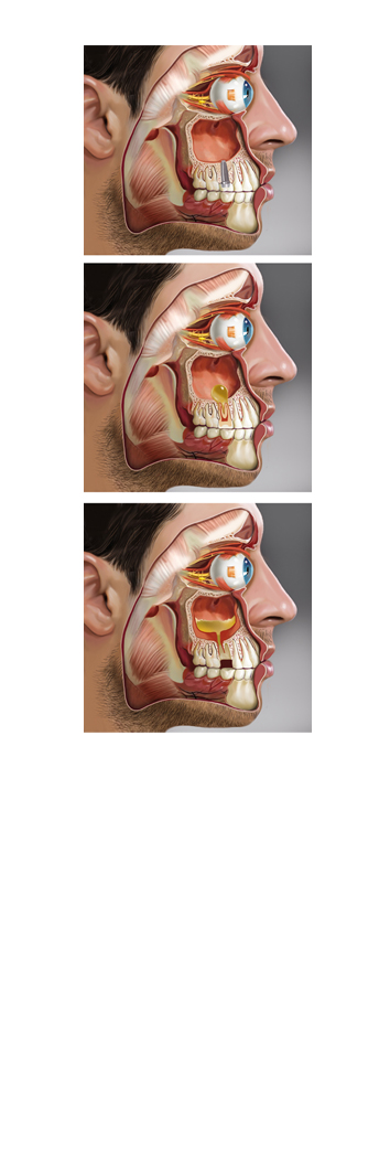 %d1%81%d0%ba%d0%bb%d0%b5%d0%b91