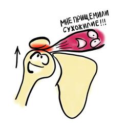 Импинджмент