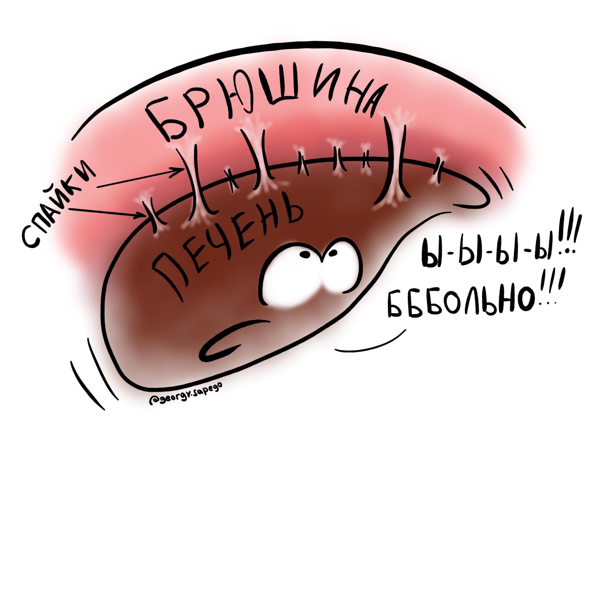 Перигепатит