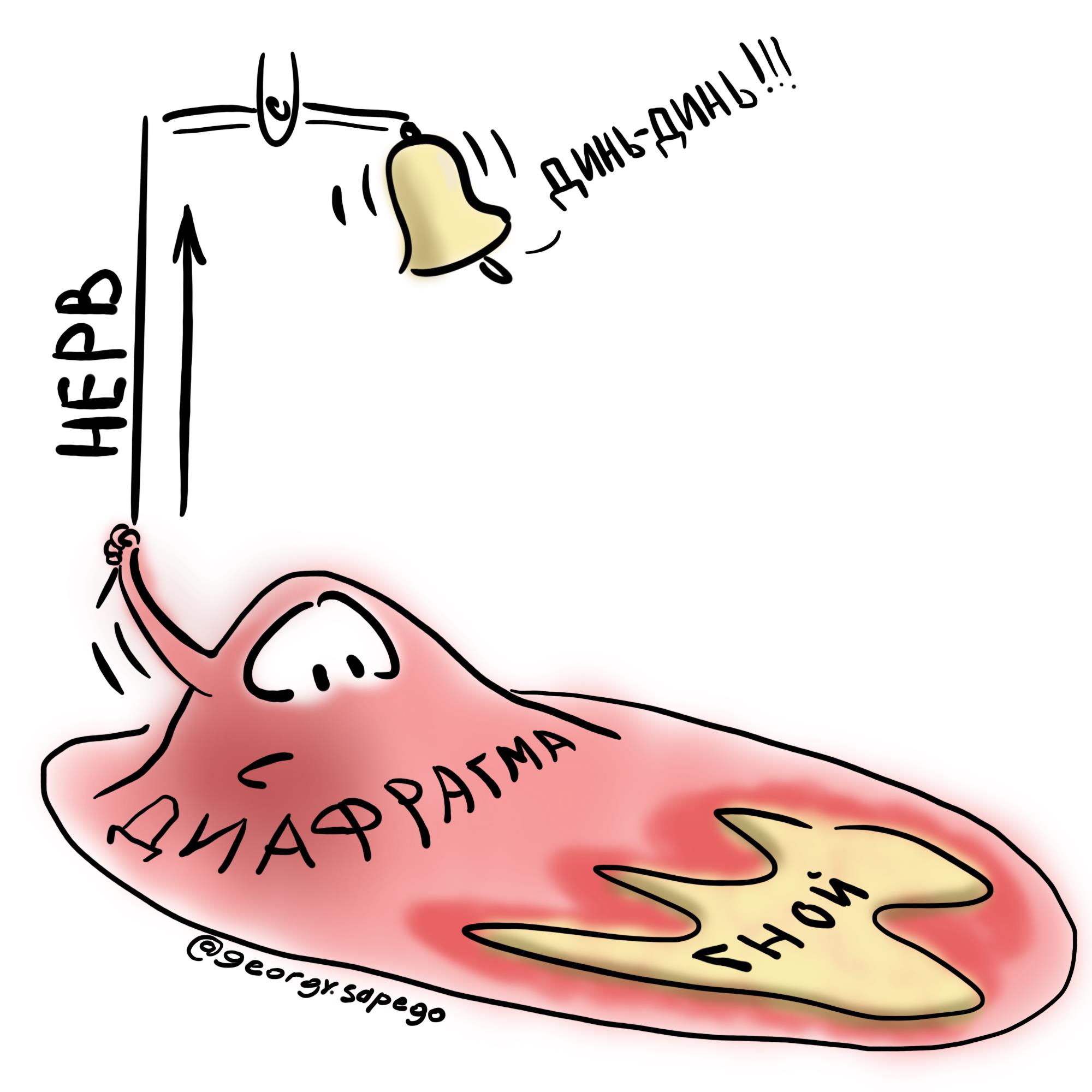 Френикус-симптом