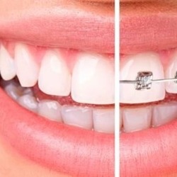 Ю-КЛИНИК, стоматологическая клиника, диагностика зубов, лечение зубов