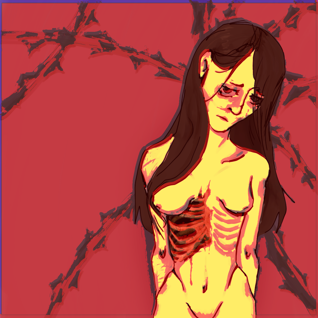 Синдром котара