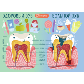 Плакат "Здоровый и больной зуб"