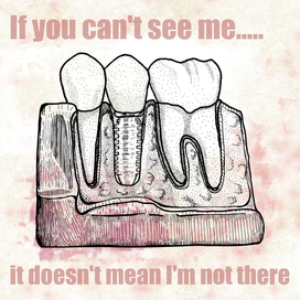 Имплантация постер