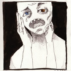 гетерохромия