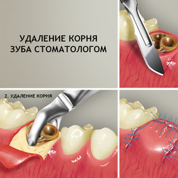 для стоматологий 23